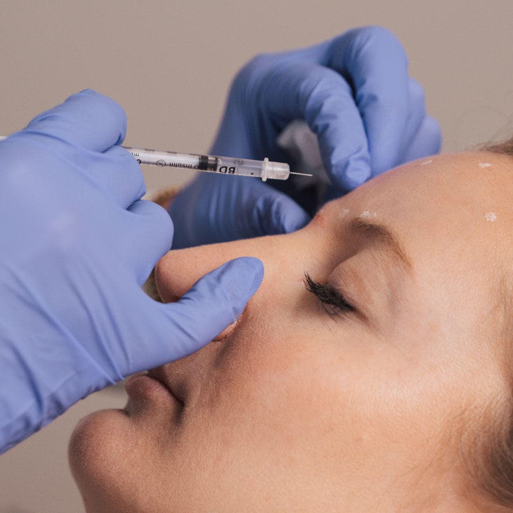 Laser Center of Marin bietet umfassende Botox-Behandlungen in Corte Madera an