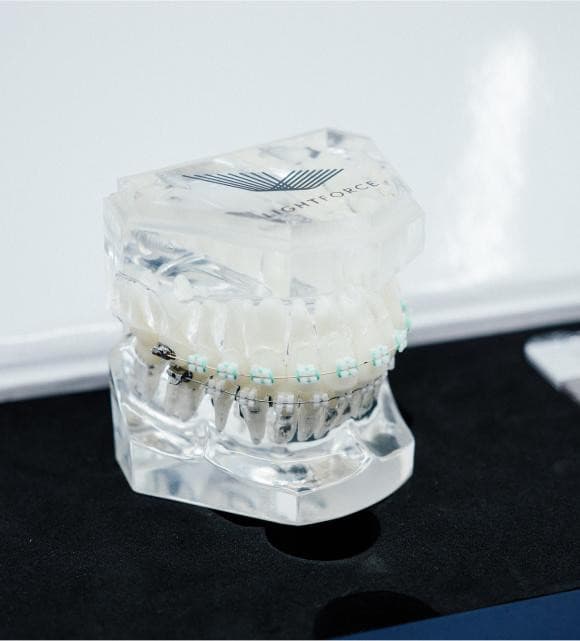 TG Orthodontics führt Lightforce-Zahnspangen für maßgeschneiderte Lächeln-Transformationen ein