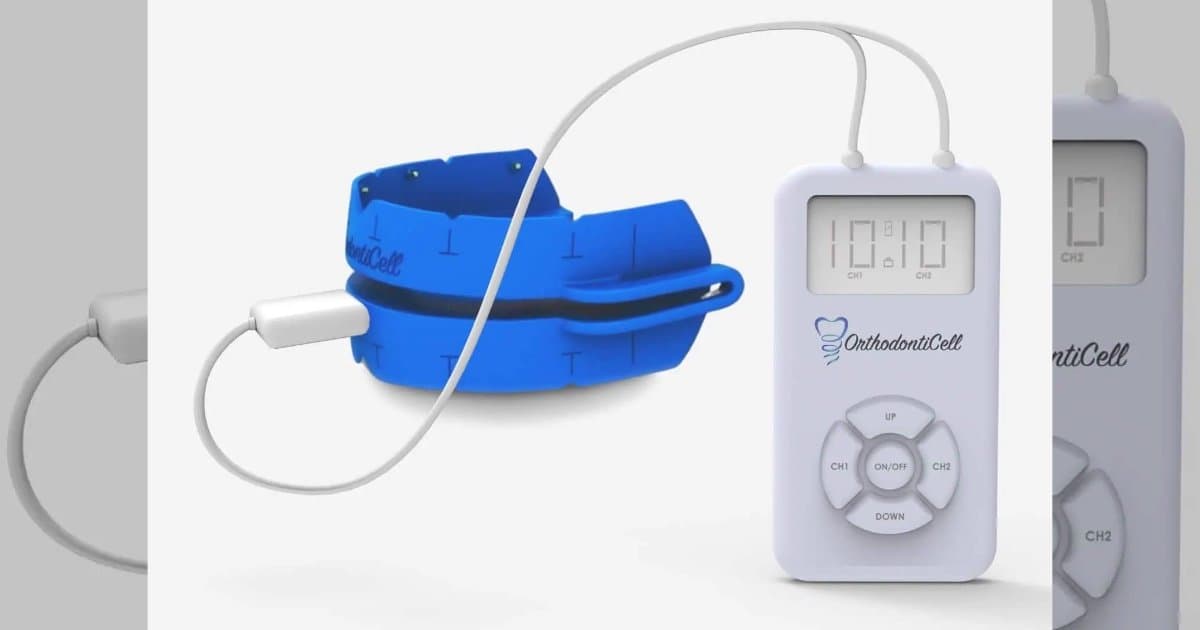 OrthodontiCell sichert sich Kapital zur Vollendung der Tests für geplante US-Phase-II-Pivotalstudie