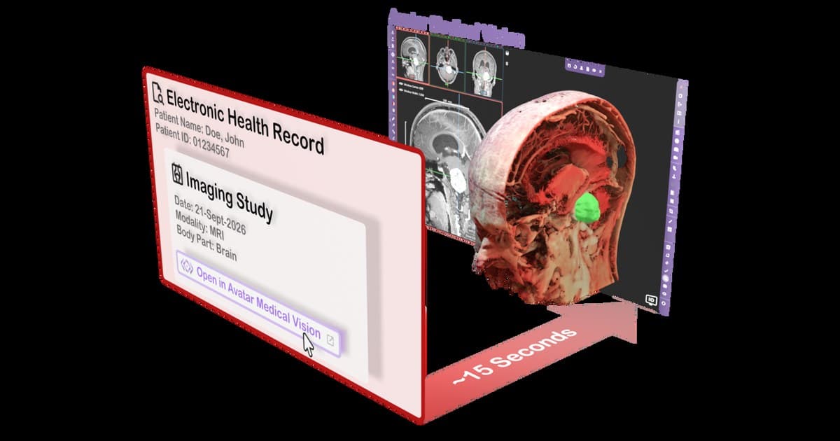 Avatar Medical integriert patientenspezifische 3D-Bildgebung in Epic EHR zur Optimierung klinischer Konsultationen